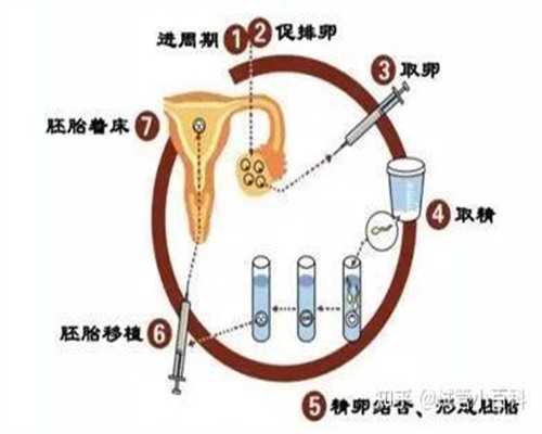 零首付包成功_助代怀孕包成功,多囊促排后怀孕的几率有多大