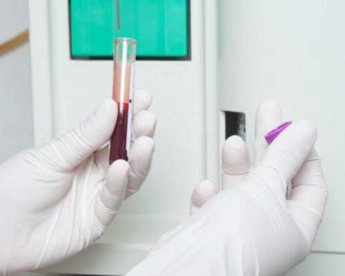 试管包儿子吗,y染色体微缺失可以做试管吗，y染色体微缺失试管婴儿