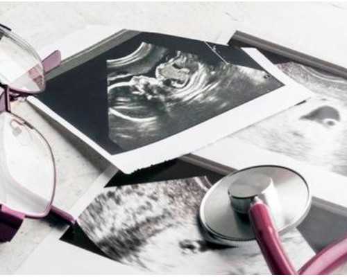 做护士移植试管要多少钱，护士做了试管移植能上班吗